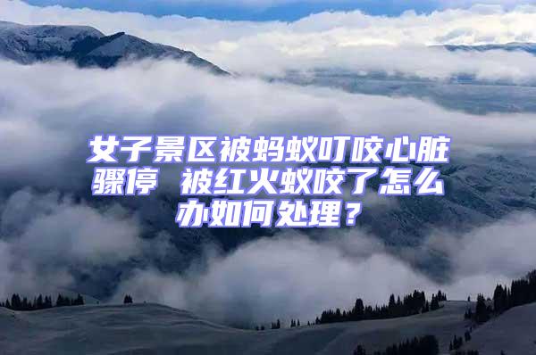 女子景區被螞蟻叮咬心臟驟停 被紅火蟻咬了怎么辦如何處理？